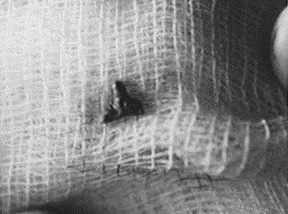 Alien Implant Alien Implant